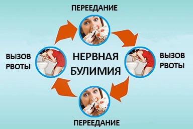 Лечение булимии в Мурмашах